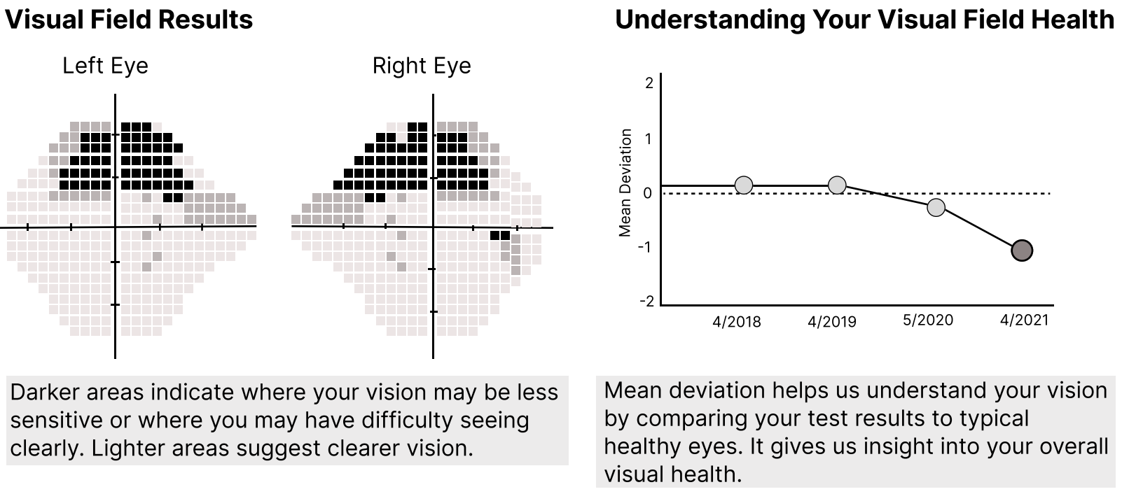 Visual Field Results greyscale charts for Left and Right eyes alongside a line graph tracking Mean Deviation from 4/2018 to 4/2021, with patient-friendly explanatory notes below each visual.