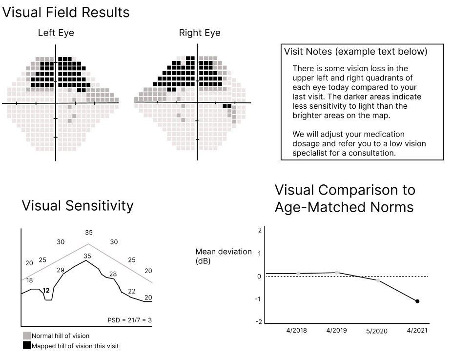 First digital version layout showing visual field results, visit notes, visual sensitivity graph, and comparison to age-matched norms