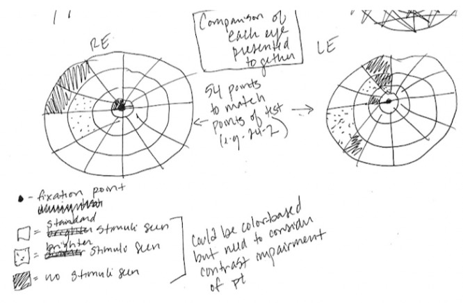 Hand-drawn diagram of comparison of right and left eye visual field points and stimuli sensitivity scale
